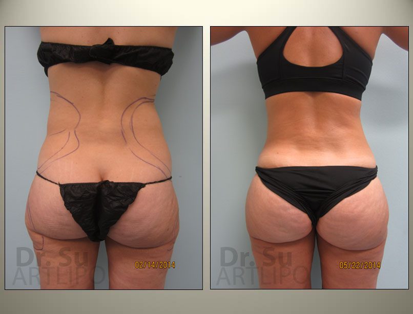 before-and-after-img
