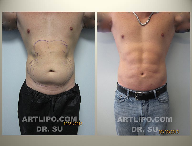 before-and-after-img