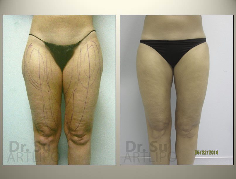 before-and-after-img