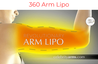 360 Arm Lipo