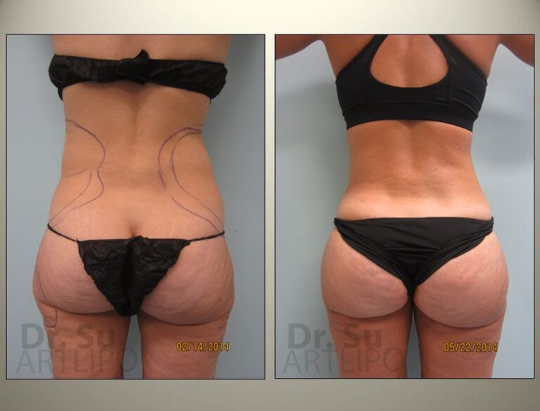 patient photo