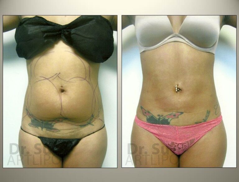 patient photo