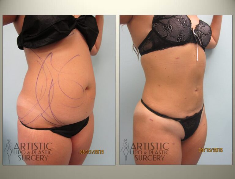 patient photo