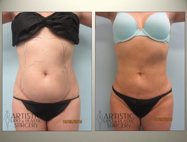 patient photo