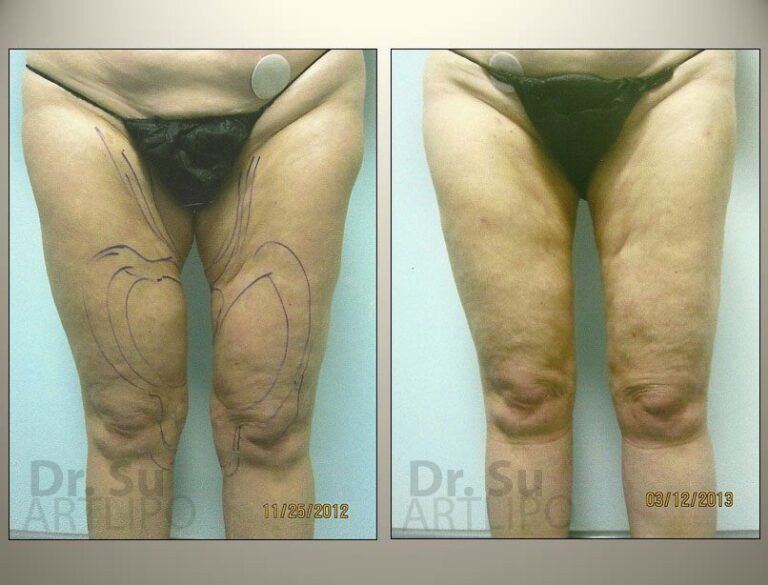 patient photo