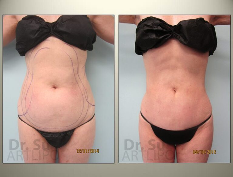 patient photo