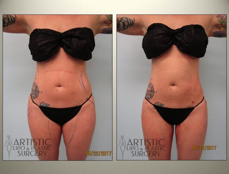 patient photo