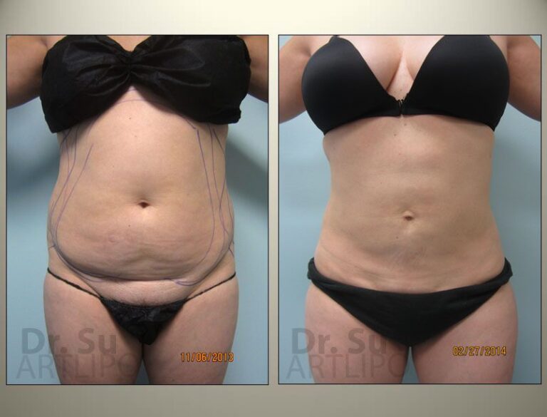 patient photo