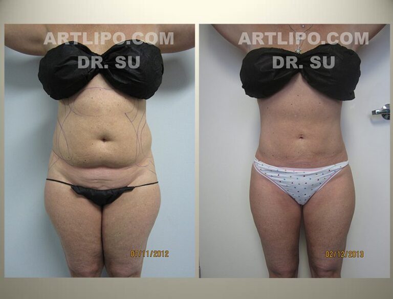 patient photo