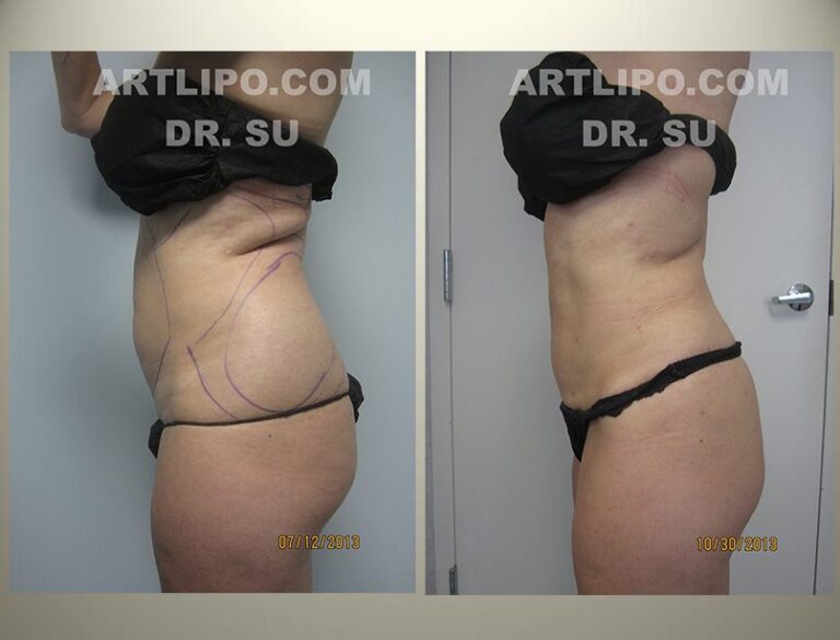 patient photo