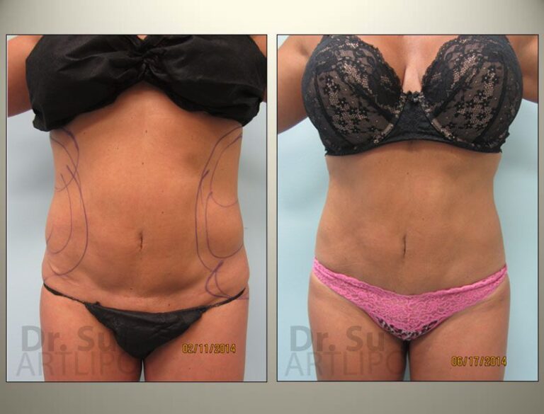 patient photo