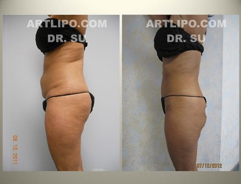 patient photo