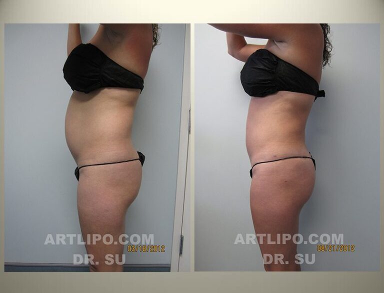 patient photo
