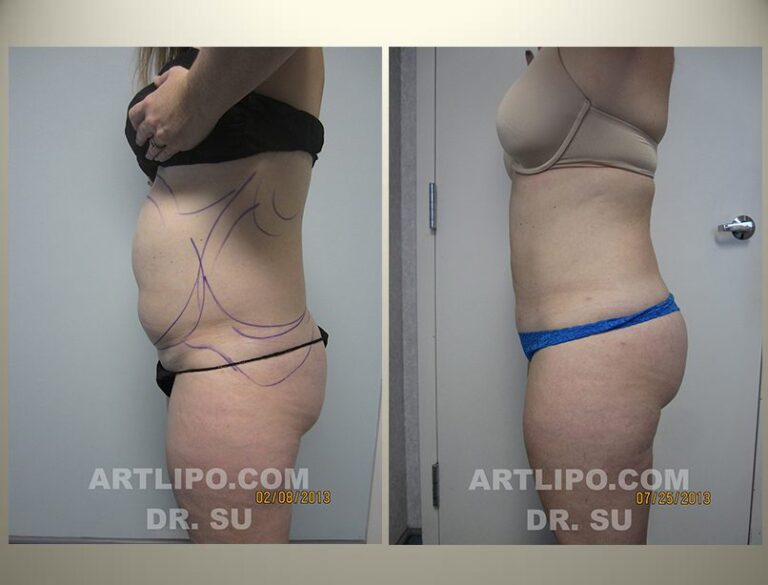 patient photo