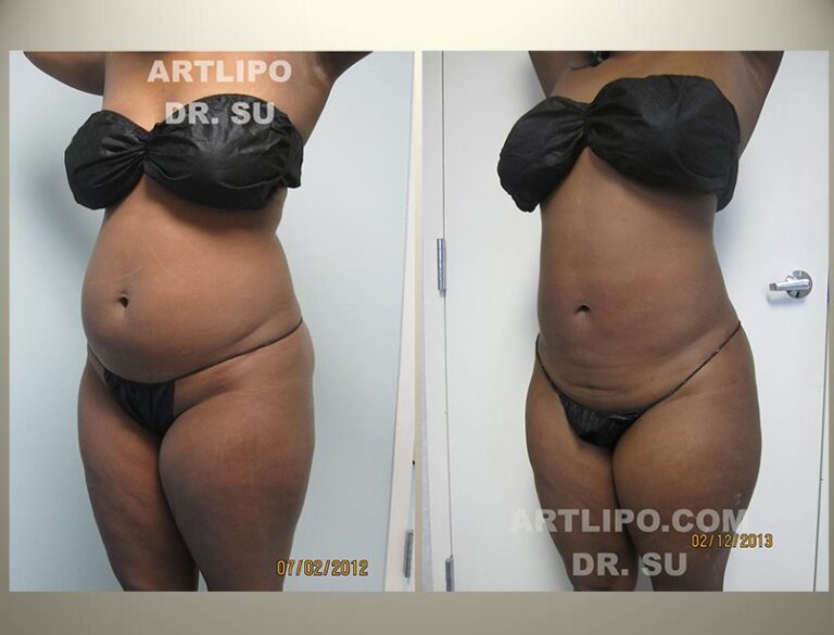 patient photo