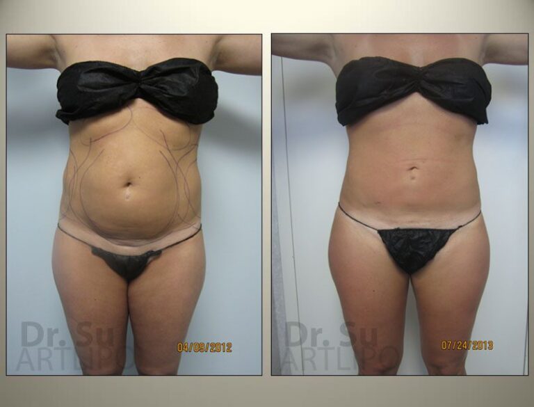 patient photo