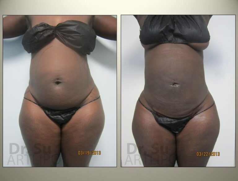 patient photo