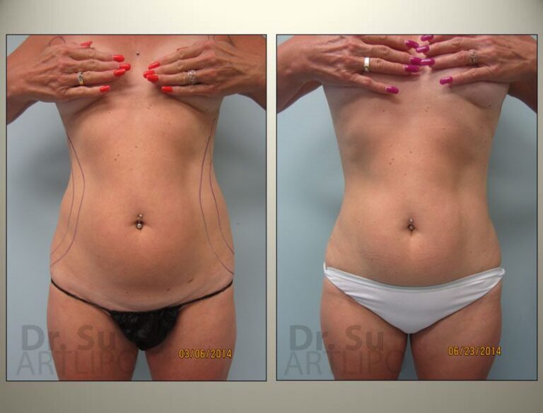 patient photo