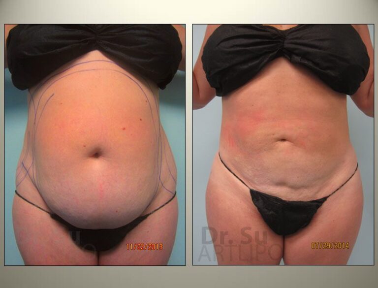 patient photo
