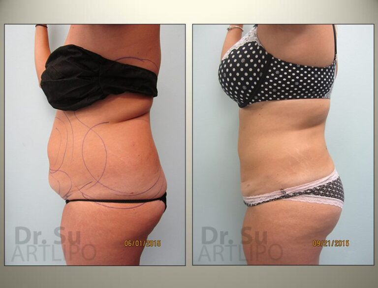 patient photo
