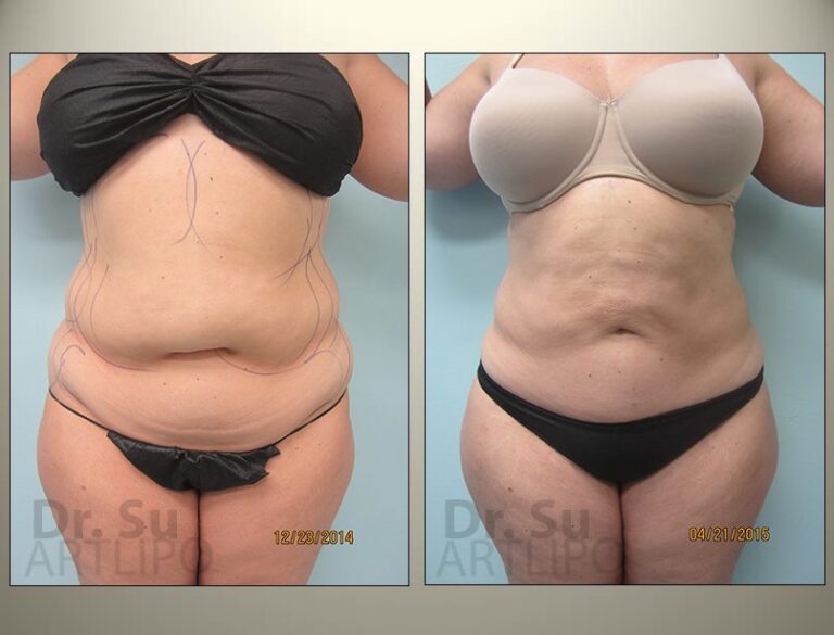 patient photo
