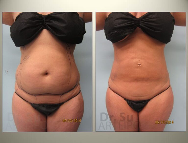 patient photo