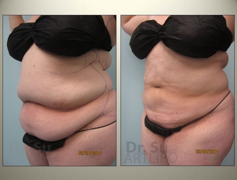 patient photo