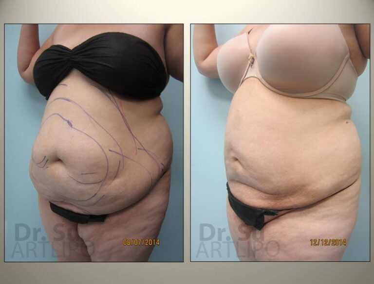patient photo