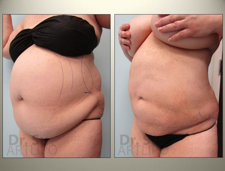 patient photo