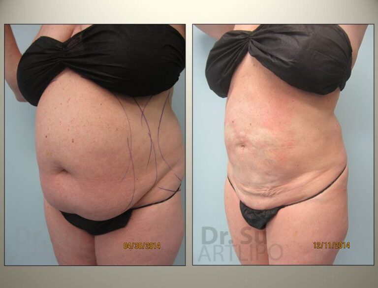 patient photo