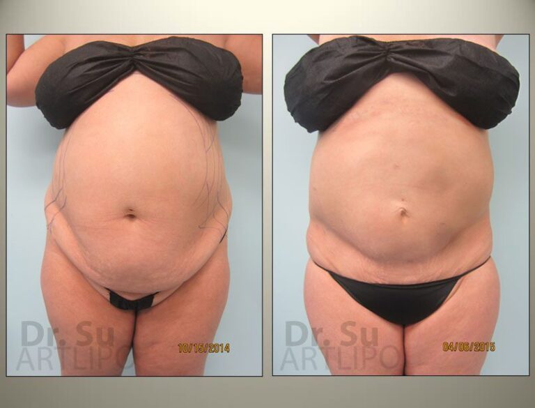 patient photo