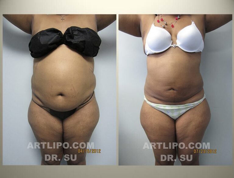 patient photo