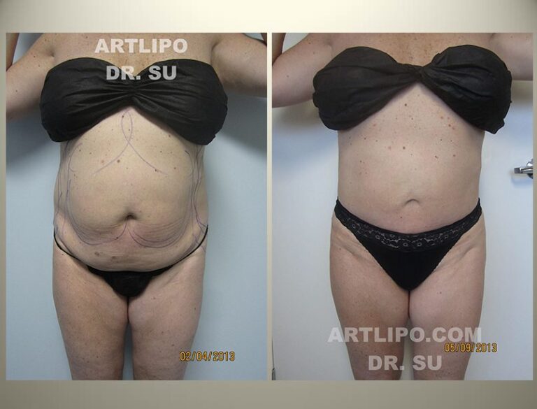 patient photo