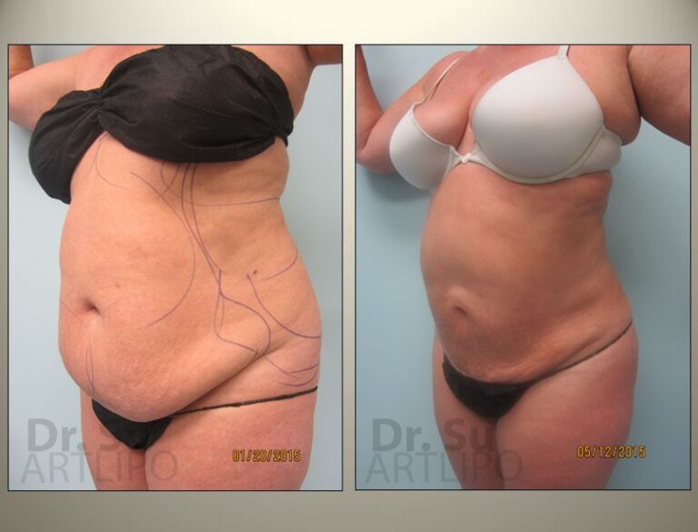 patient photo