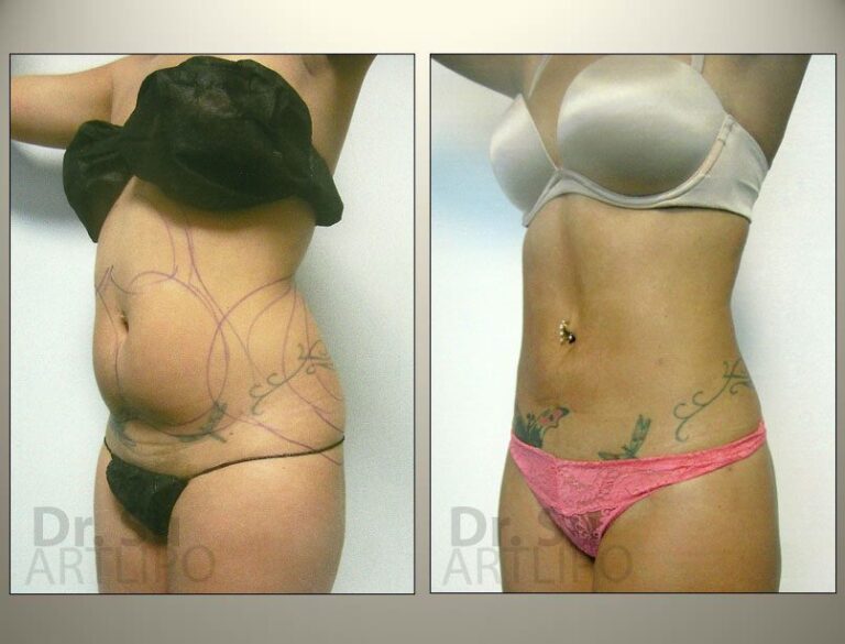 patient photo
