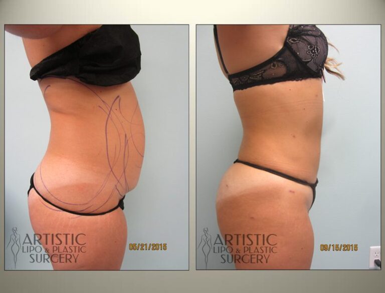patient photo