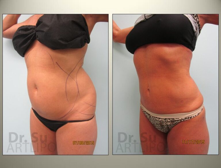 patient photo