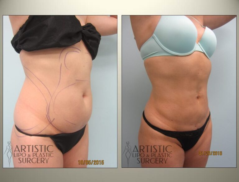 patient photo