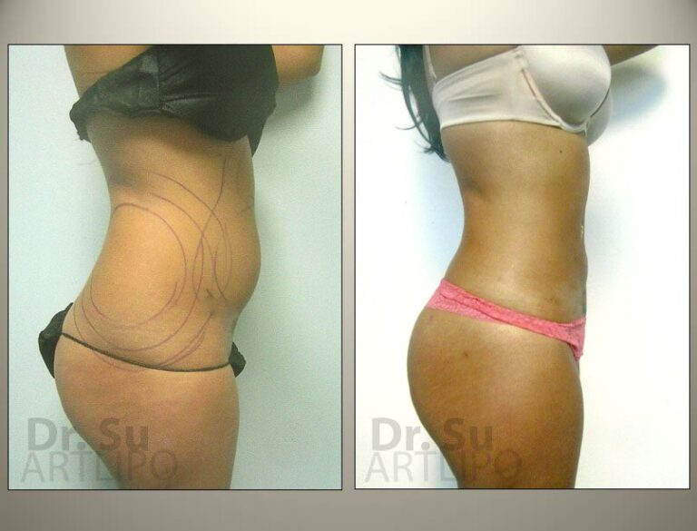 patient photo