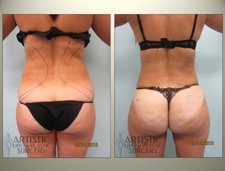 patient photo