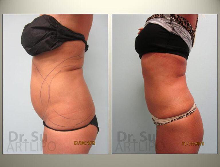 patient photo