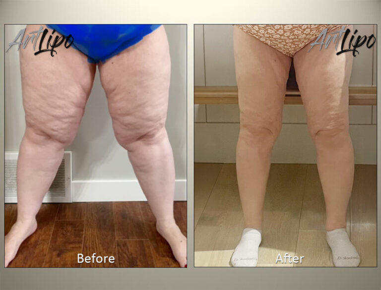 patient photo