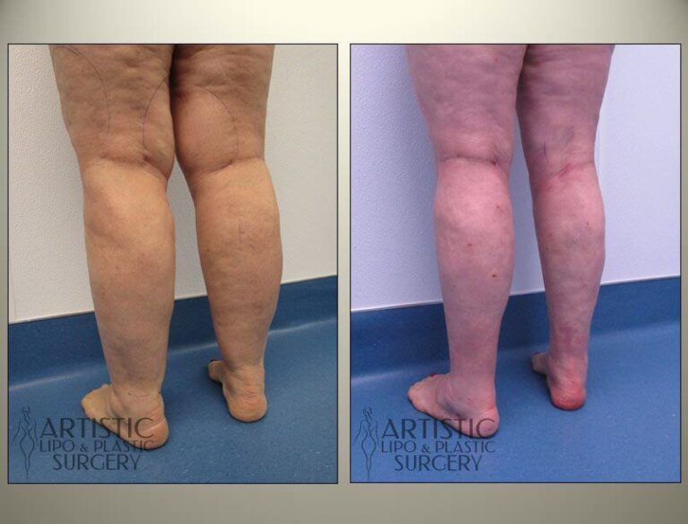 patient photo