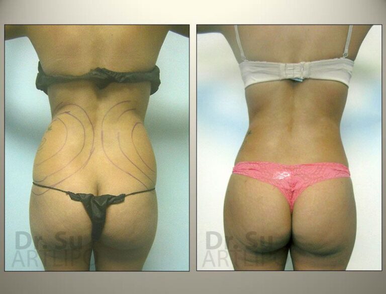 patient photo