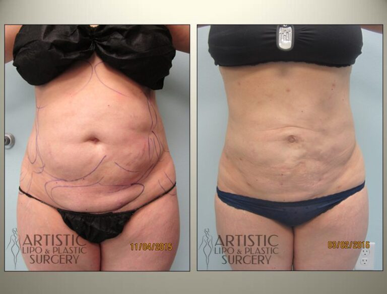 patient photo