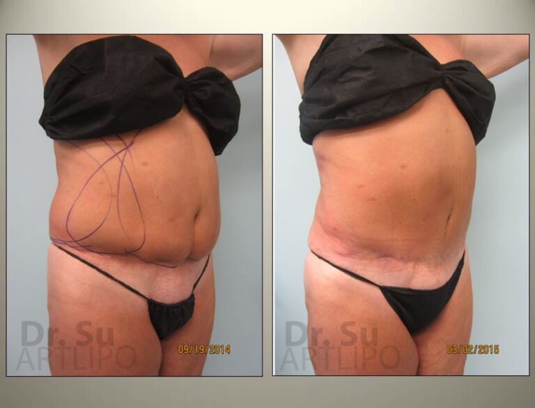patient photo