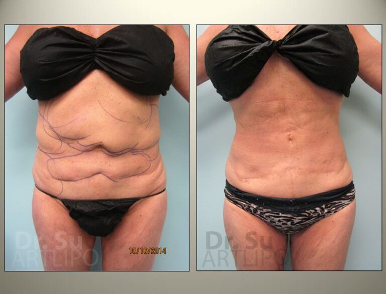 patient photo