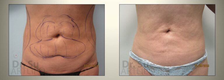 patient photo