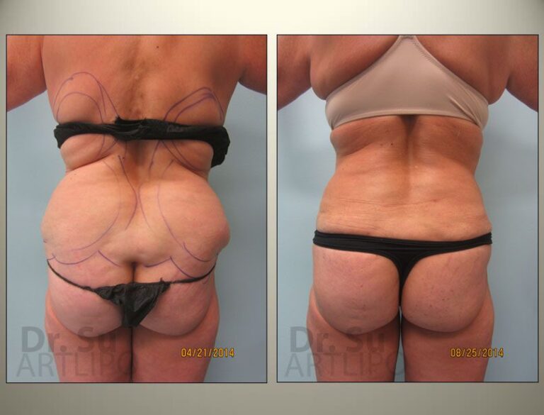 patient photo
