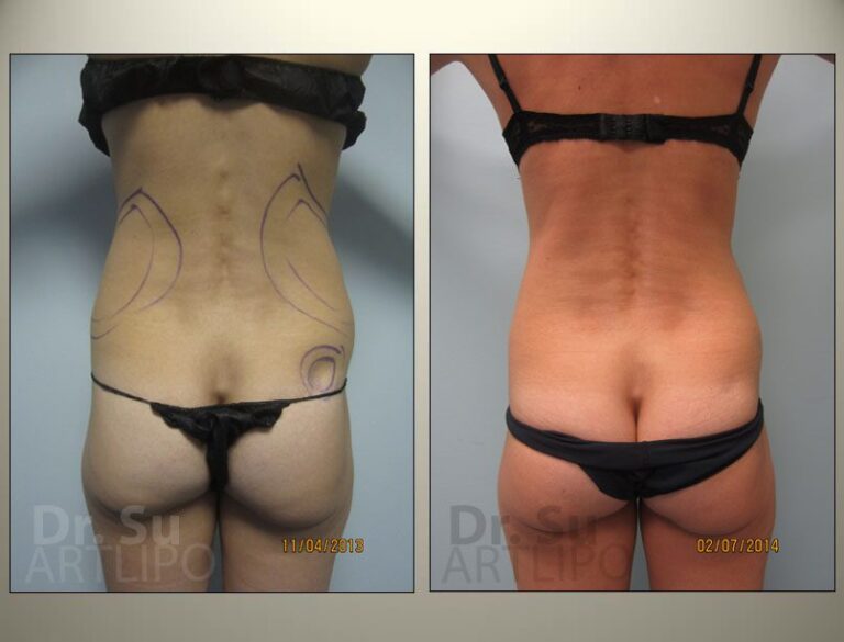 patient photo